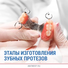 Этапы изготовления зубных протезов