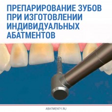 Препарирование зубов при изготовлении индивидуальных абатментов 