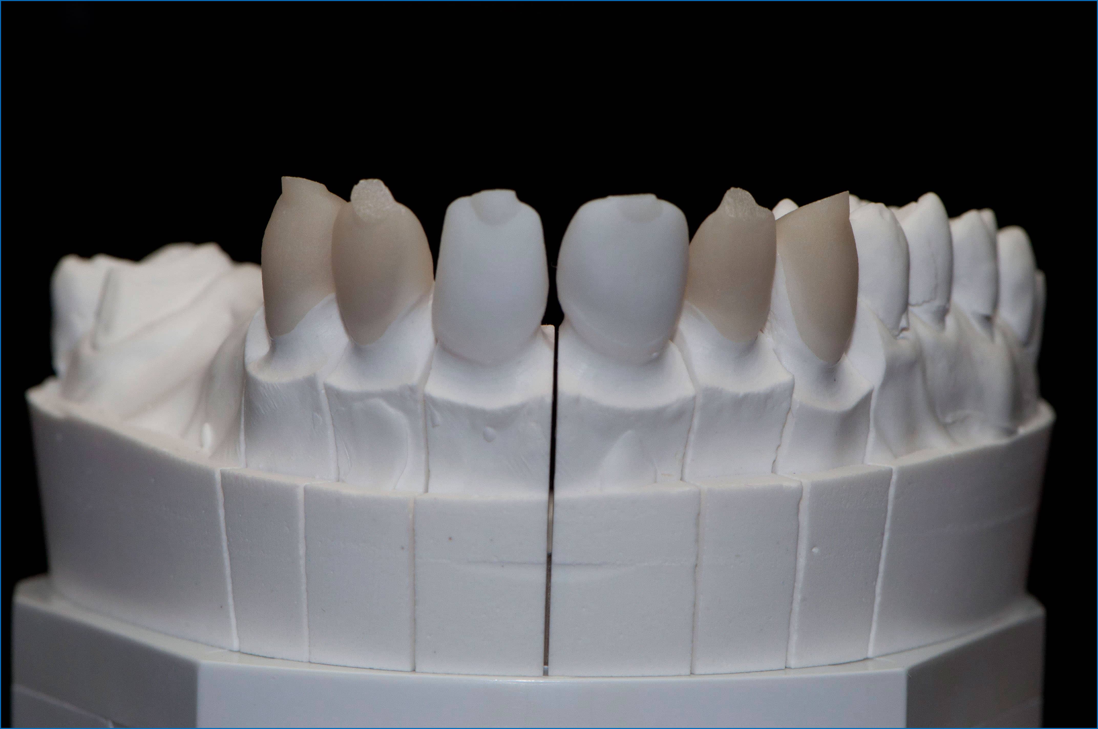 Купить материал для зубов. Моделировочные материалы в ортопедической стоматологии. Фиксирующие материалы в ортопедической стоматологии. Формовочные материалы в ортопедической стоматологии. Эластичные базисные материалы в ортопедической стоматологии.