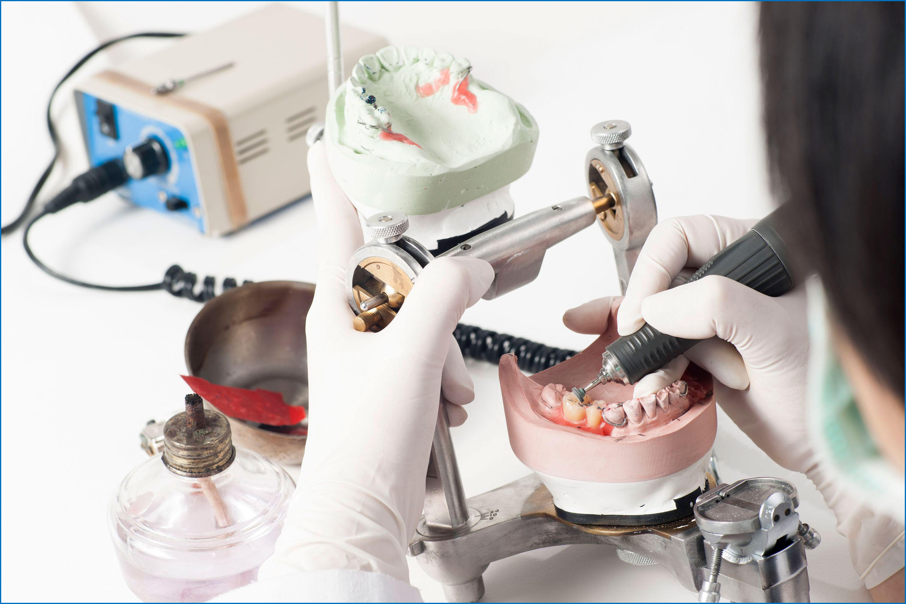 Протезы зуботехническая лаборатория