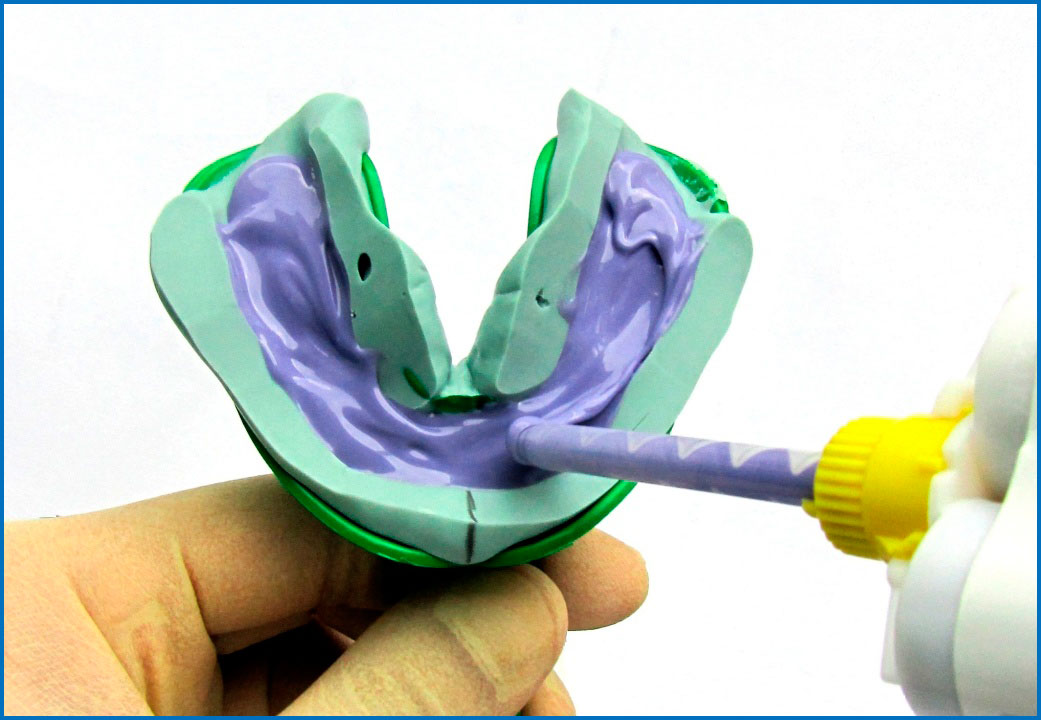 Оттискные материалы в ортопедической стоматологии